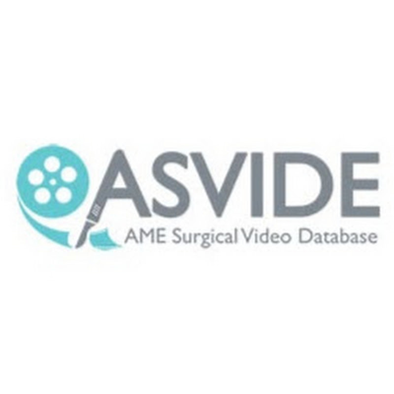 ASVIDE